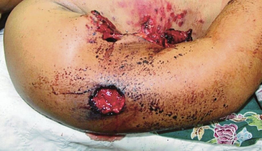 Lelaki Tembak Isteri dan Kelar Leher Sendiri Kerana 