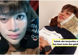 sakit mata pondan