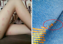 bugs