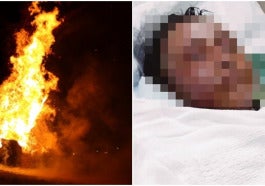 burn wanita