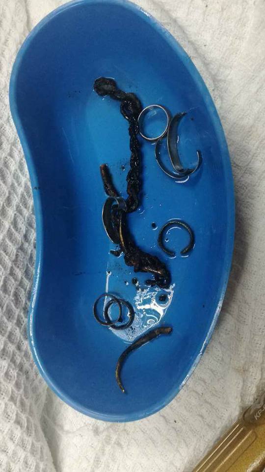 Tangan3