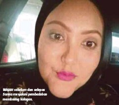 "Kenapa dagu pelik, terpisah dari muka?" - Wanita Cucuk 