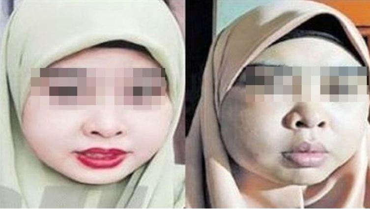 muka