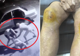 Three Elderly Folks Brutally Beaten Up And Robbed When Going For Morning Walk World Of Buzz 4