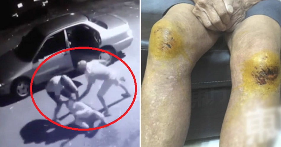 Three Elderly Folks Brutally Beaten Up And Robbed When Going For Morning Walk World Of Buzz 4