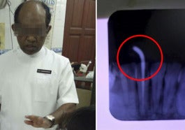 Lady Gets Braces At Ampang Clinic Ends Up With Horrible Infection And Damaged Roots World Of Buzz