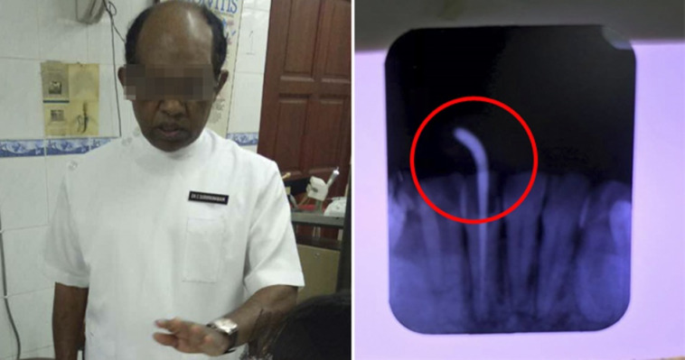 Lady Gets Braces At Ampang Clinic Ends Up With Horrible Infection And Damaged Roots World Of Buzz