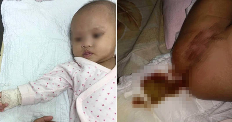 Wanita Terkejut Selepas Dapati Najis Anak Berdarah, Rupa 