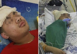 Healthy Young Man Suffered From Headache And Fever Died After Two Weeks World Of Buzz