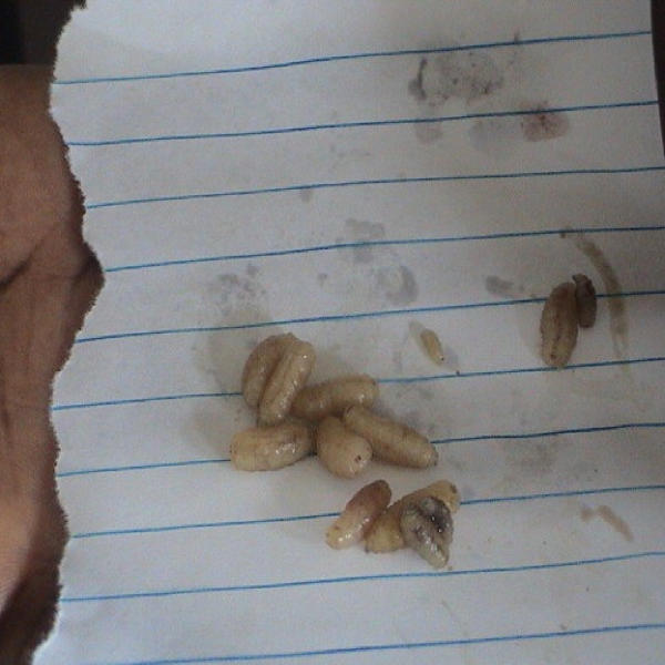 The Extracted Tumbu Fly Larvae