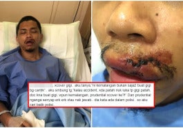 kemalangan