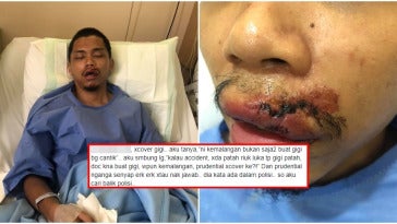 Tampal Sahaja Kalau Gigi Tu Berlubang, Dentist Ini 