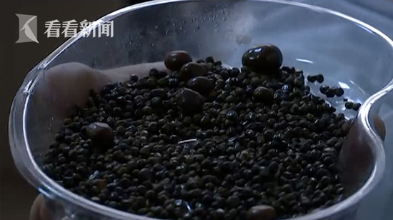 doctors remove over 2000 gallstones from woman who doesnt eat breakfast drinks less water world of buzz 3