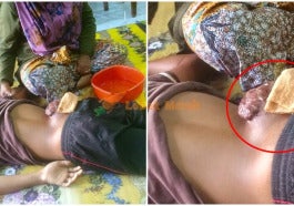 ketumbuhan pinggang