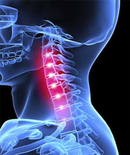 Neck Pain Causes Headache