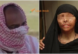 Curah Asid Dekat Isteri