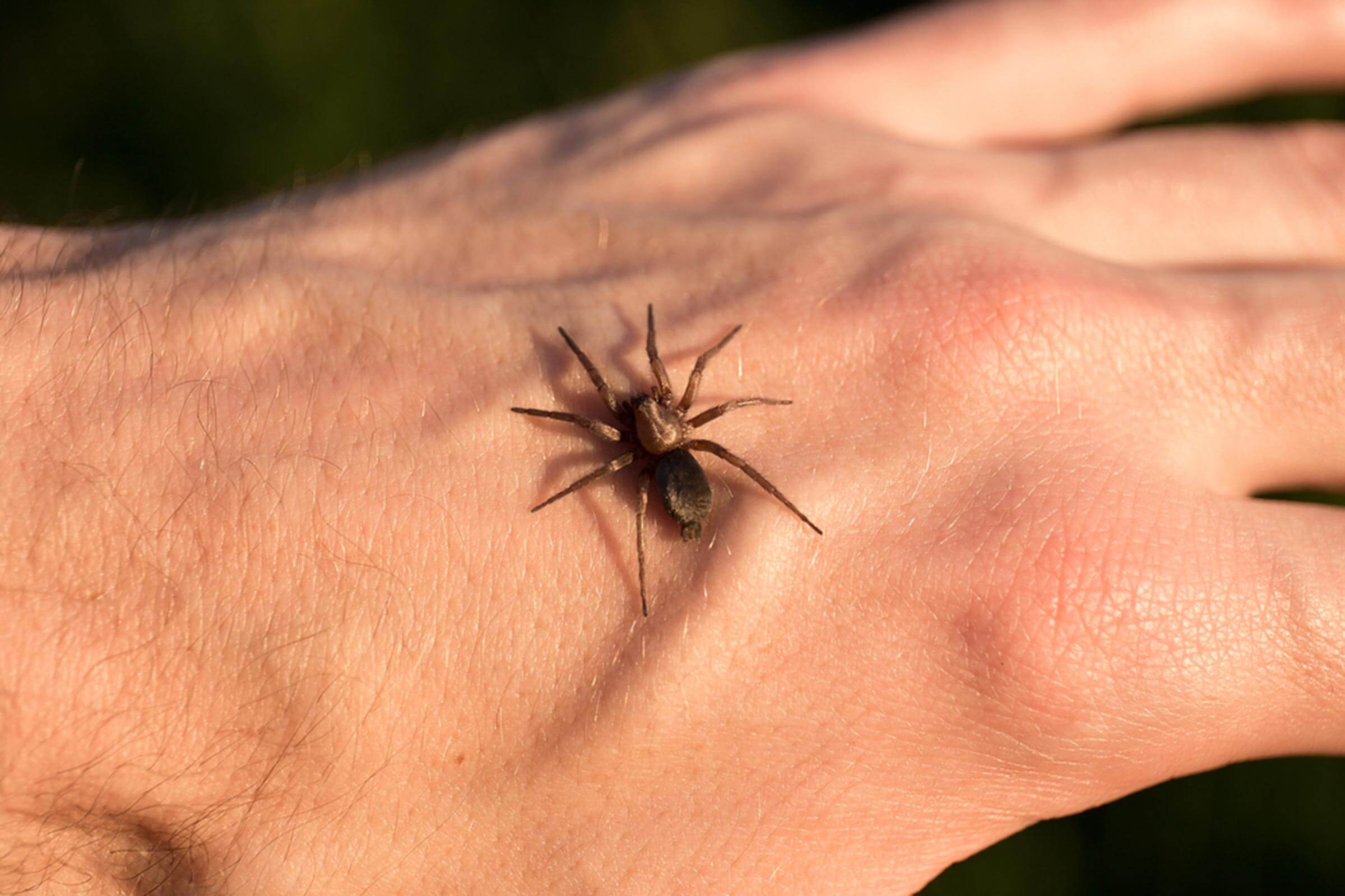 05 spider Bug Bite Symptoms You Should Never Ignore—and What Is Causing Them 506854405 Goncharov Artem
