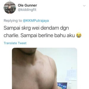 "Melecur kalau kena gigit" - Ini Cara Merawat Kesan 