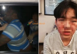 man punched stabbed in the eye in damansara by driver who banged his car tried to run away world of buzz 2 1024x537