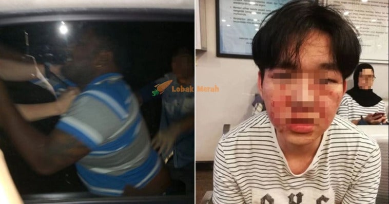 man punched stabbed in the eye in damansara by driver who banged his car tried to run away world of buzz 2 1024x537