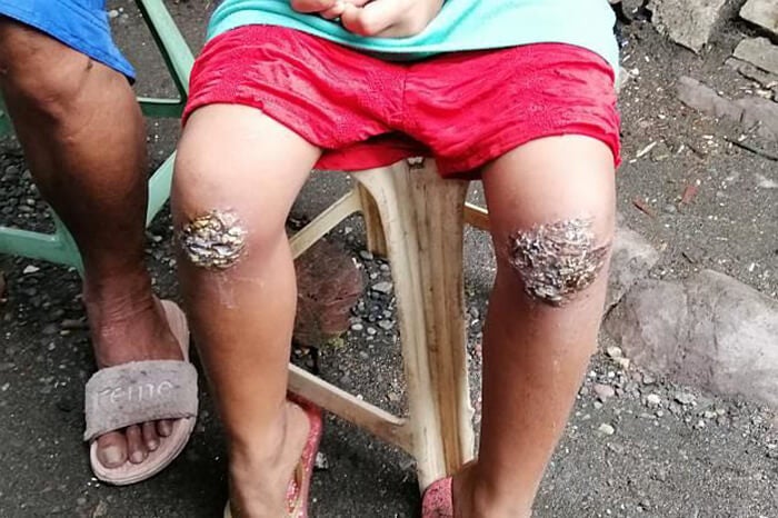 8yo philippine girl forced to kneel on embers for forgetting to bring her bag home world of buzz 3