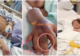 Feature Image Budak Kena Patuk Ular