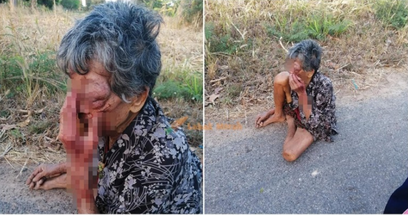 Gambar Orang Kesakitan  Dorang pura pura nangis menipu dipukul Gadis 19 Tahun 