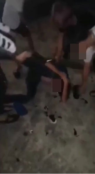 Johor Man Gets Beaten Had His Genitals Burned By Angry Mob After 16Yo Girl Claims He Raped Her World Of Buzz 8