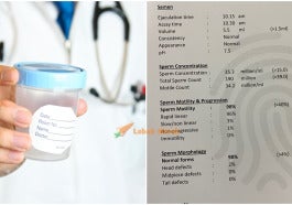 spermtest