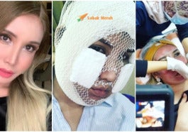 Safieyeye E1612577580984