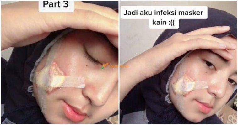 ft mask