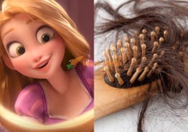 5 Bulan Tahan Sakit Doktor Sahkan Remaja Ada Sindrom Rapunzel Lepas Jumpa Gumpalan Rambut Di Dalam Perut