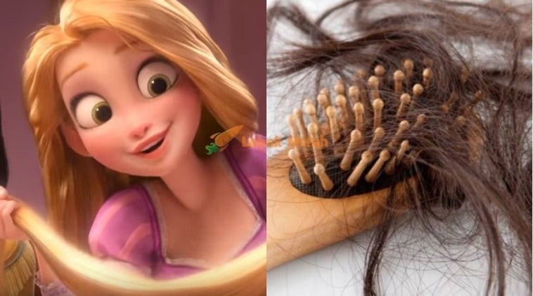 5 Bulan Tahan Sakit Doktor Sahkan Remaja Ada Sindrom Rapunzel Lepas Jumpa Gumpalan Rambut Di Dalam Perut