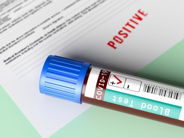 covid 19 test report positive medical report 13598 95 e1612665362759