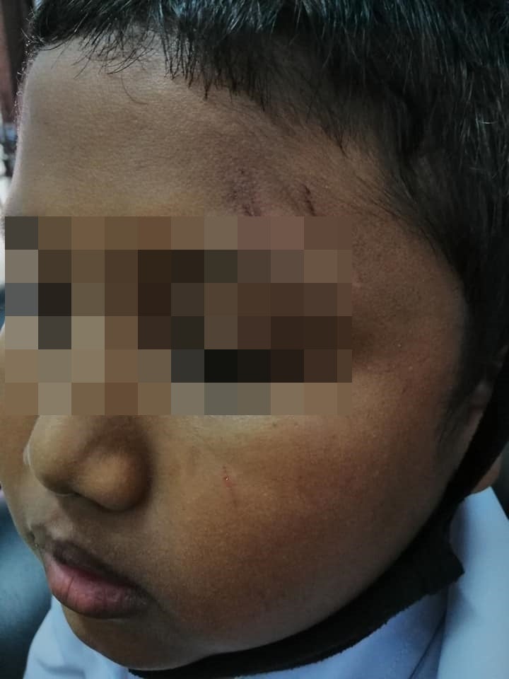 176117812 3062161680764286 4505044860877404808 N