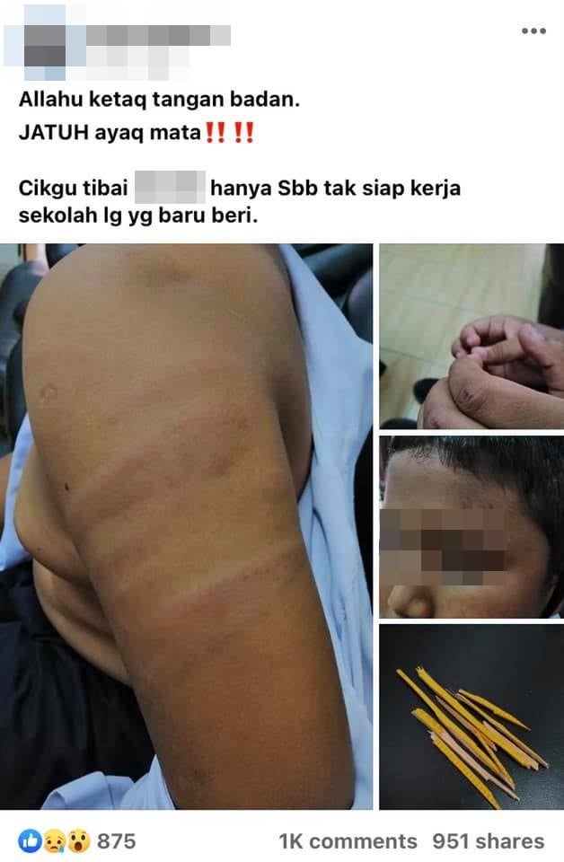 176956863 3062161430764311 1692778044005277347 N