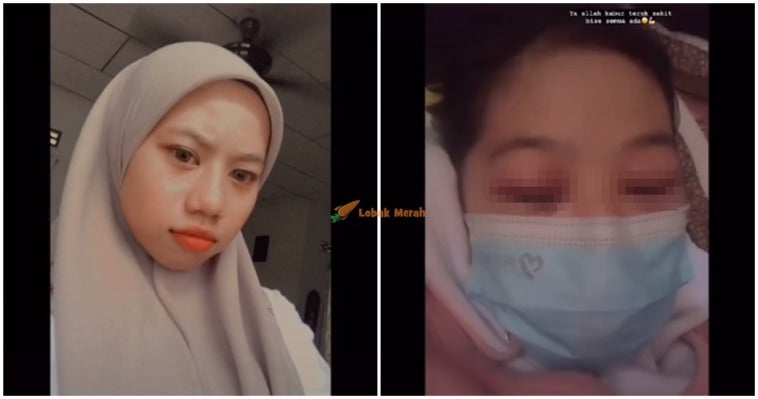 fi lens