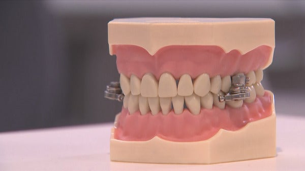 World First Weight Loss Device Developed By Researchers At Otago E1625369720513