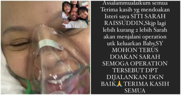 ft siti sarah ditidurkan pembedahan keluar baby 8 bulan e1628308407795