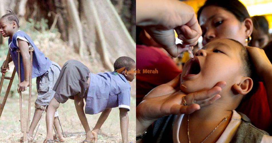 2polio