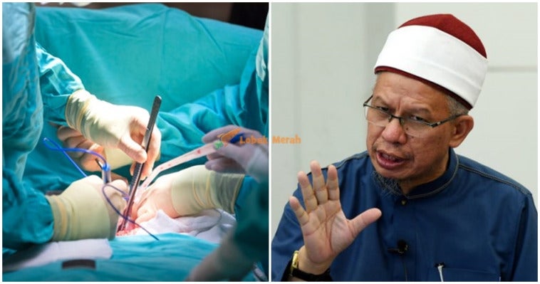 Dr Zul Jawab Isu Pemindahan Organ