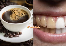 Fi Kopi Gigi