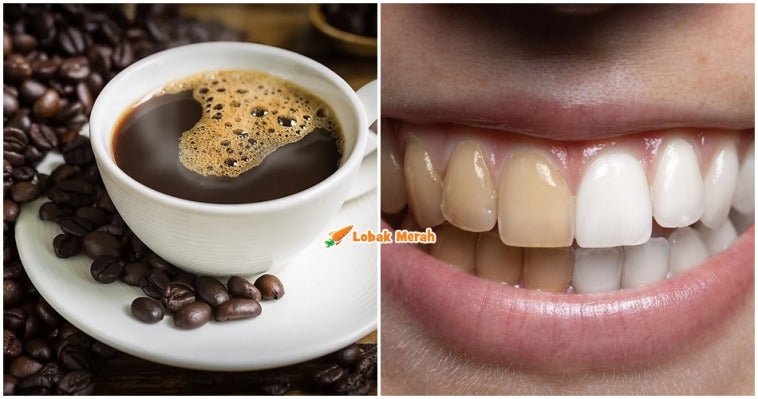 fi kopi gigi