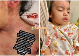 Penyakit Kawasaki Anak Amyra Rosli