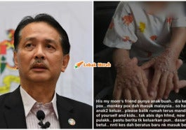 Ft Noor Hisham Respon Rumors Monkeypox