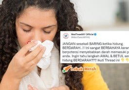 Hidung Berdarah