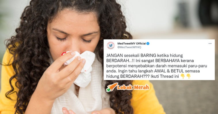 hidung berdarah