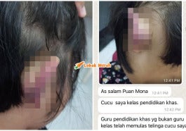 Kes Dera Budak Autism Guru Ppki
