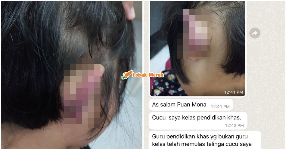 kes dera budak autism guru ppki