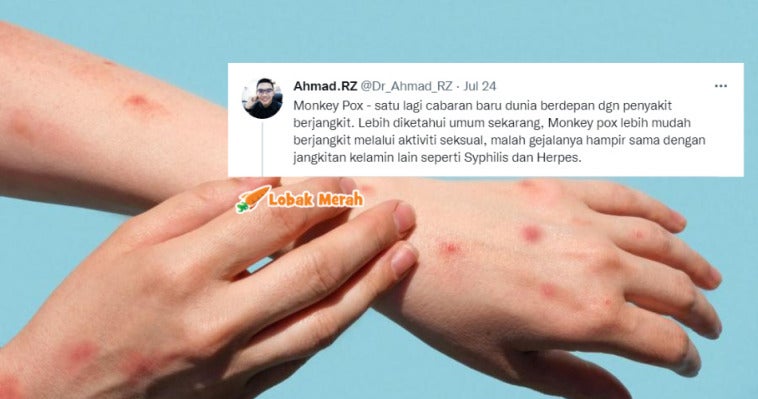 monkeypox std